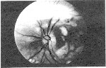 Pg 159 fundus photo #2