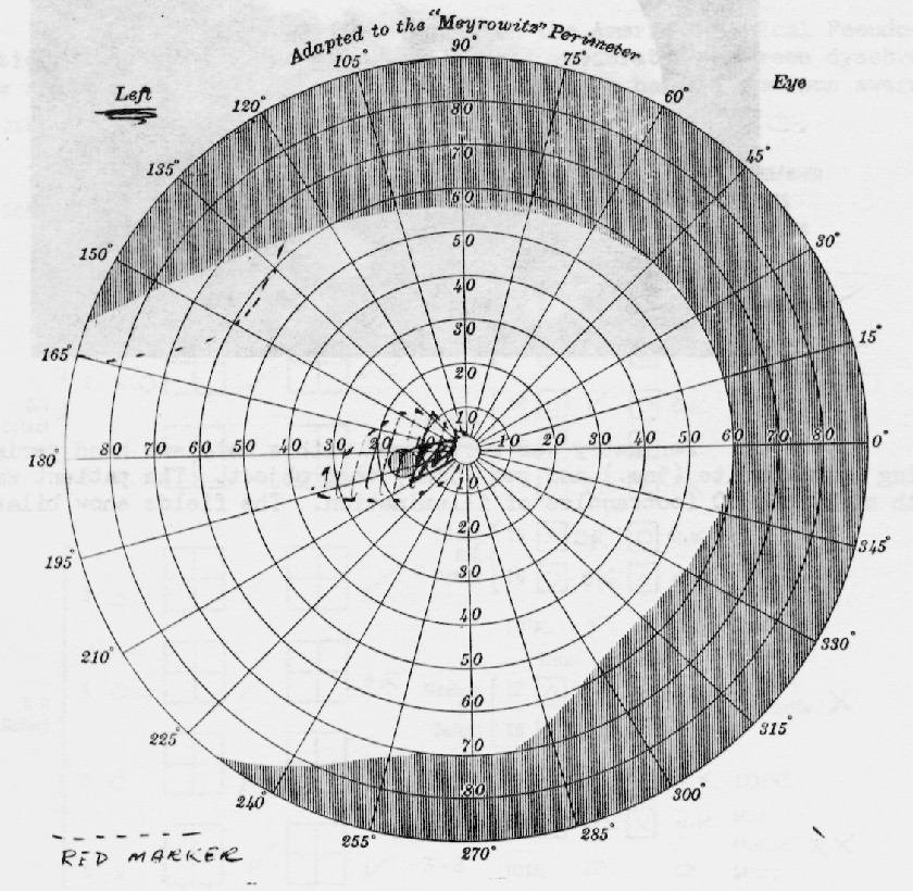 Pg 160 perimetry diagram